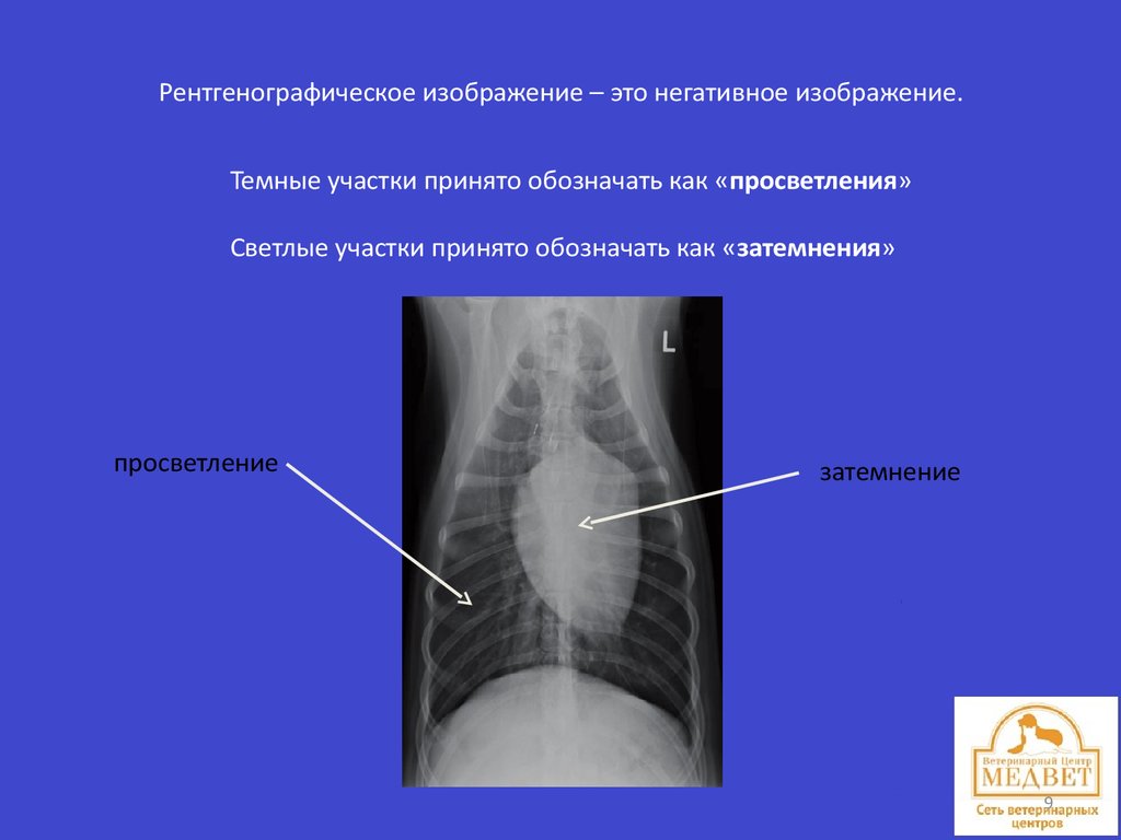 Негативное изображение рентген