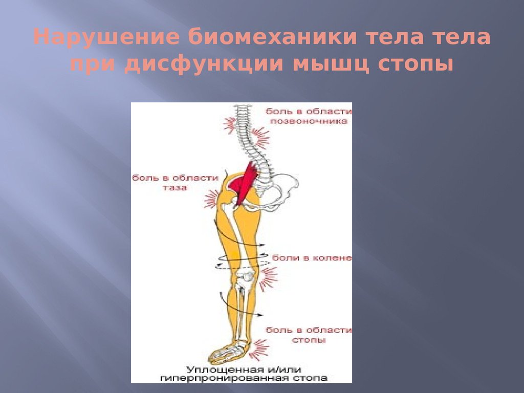 Биомеханика тела. Нарушение биомеханики. Основные принципы биомеханики в анатомии. Нарушение биомеханики движения что такое.