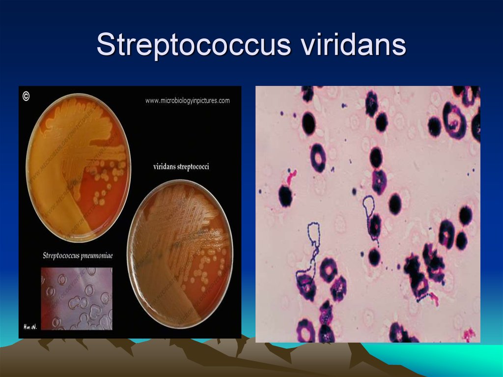 Streptococcus. Streptococcus гр Viridans 10 4. Streptococcus SPP. Группы Viridans. Стрептококк вириданс в мазке из зева.