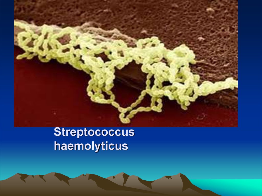 Streptococcus haemolyticus