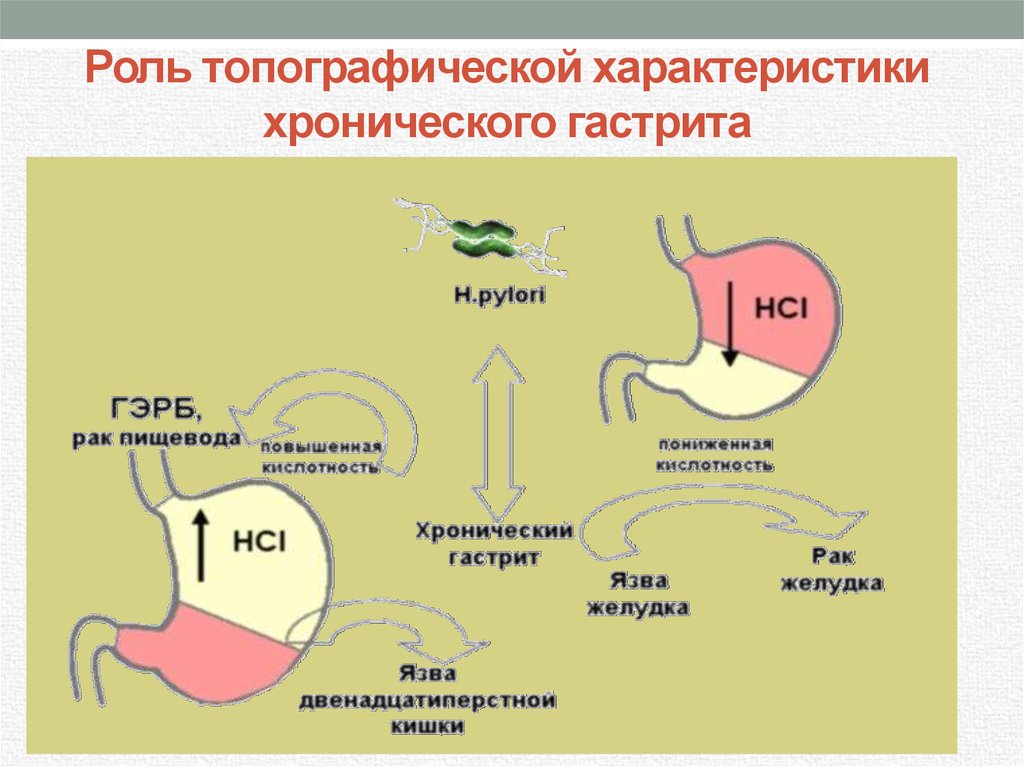 Роль топографической характеристики хронического гастрита