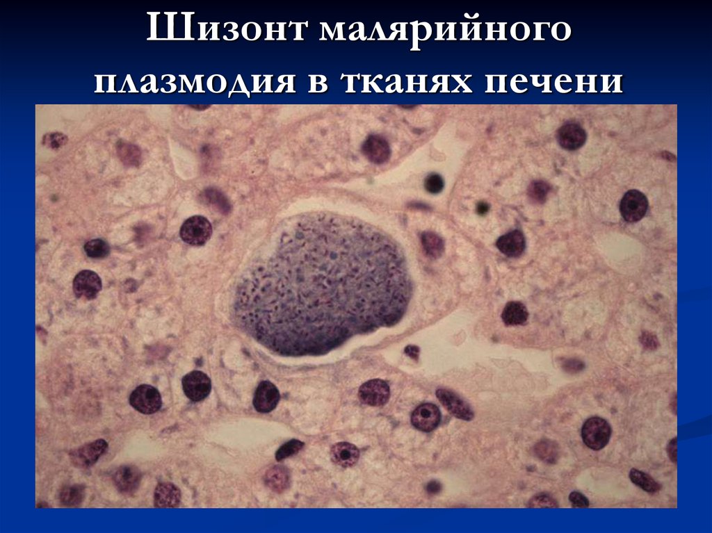 Малярийный плазмодий клетка. Малярийный плазмодий. Малярийный плазмодий шизогония мерозоиты. Малярийный плазмодий в печени. Клетка малярийного плазмодия.