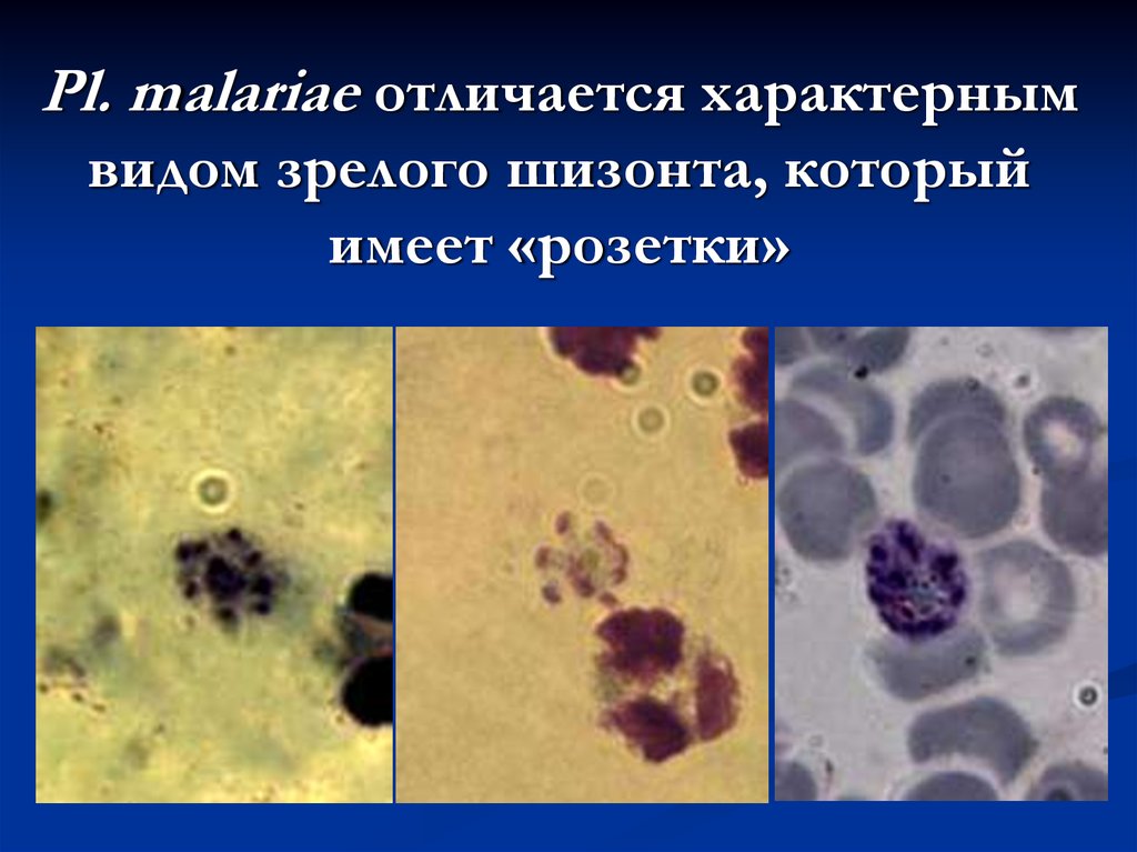 Pl. Malariae. Стадия амебовидного шизонта. Шизонты и мерозоиты. Для паразитических простейших характерно. Шизонт это