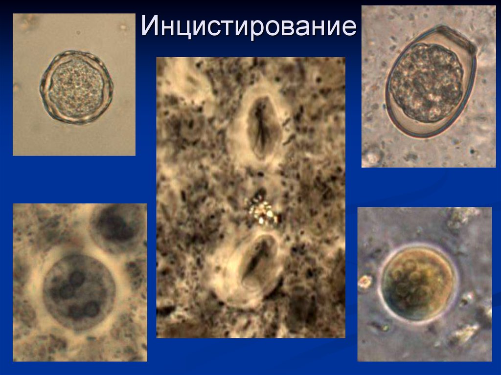 Какое значение в жизни простейших имеют цисты. Цисты простейших. Циста одноклеточных. Инцистирование. Образование цисты.