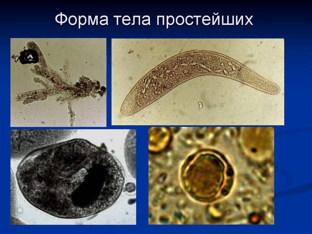 Тело простейших. Форма тела простейших. Форма тела простейших организмов. Паразитические формы простейших. Форма тела протистов.