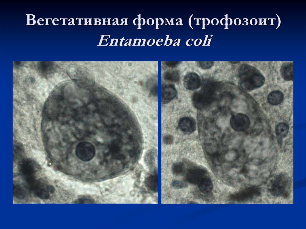 Entamoeba coli в кале. Дизентерийная амёба микроскопия. Цисты Entamoeba. Entamoeba histolytica трофозоит.