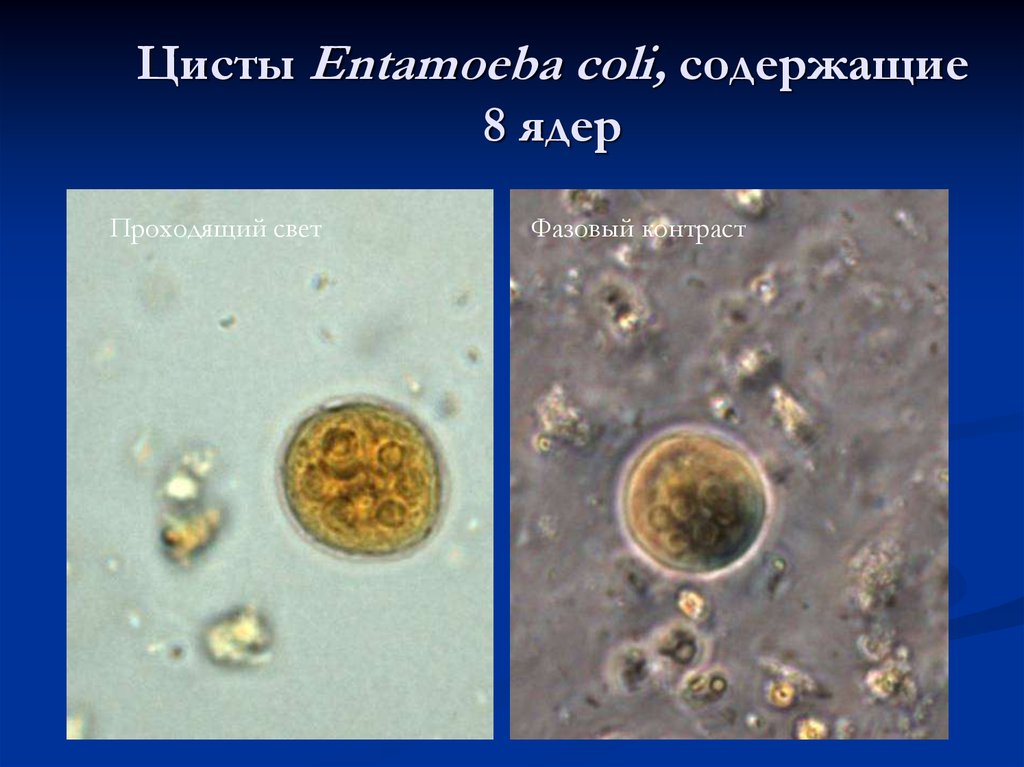 Entamoeba coli в кале. Entamoeba coli циста. Цисты Entamoeba coli 0 1. Entamoeba coli жизненный цикл. Entamoeba dispar цисты.