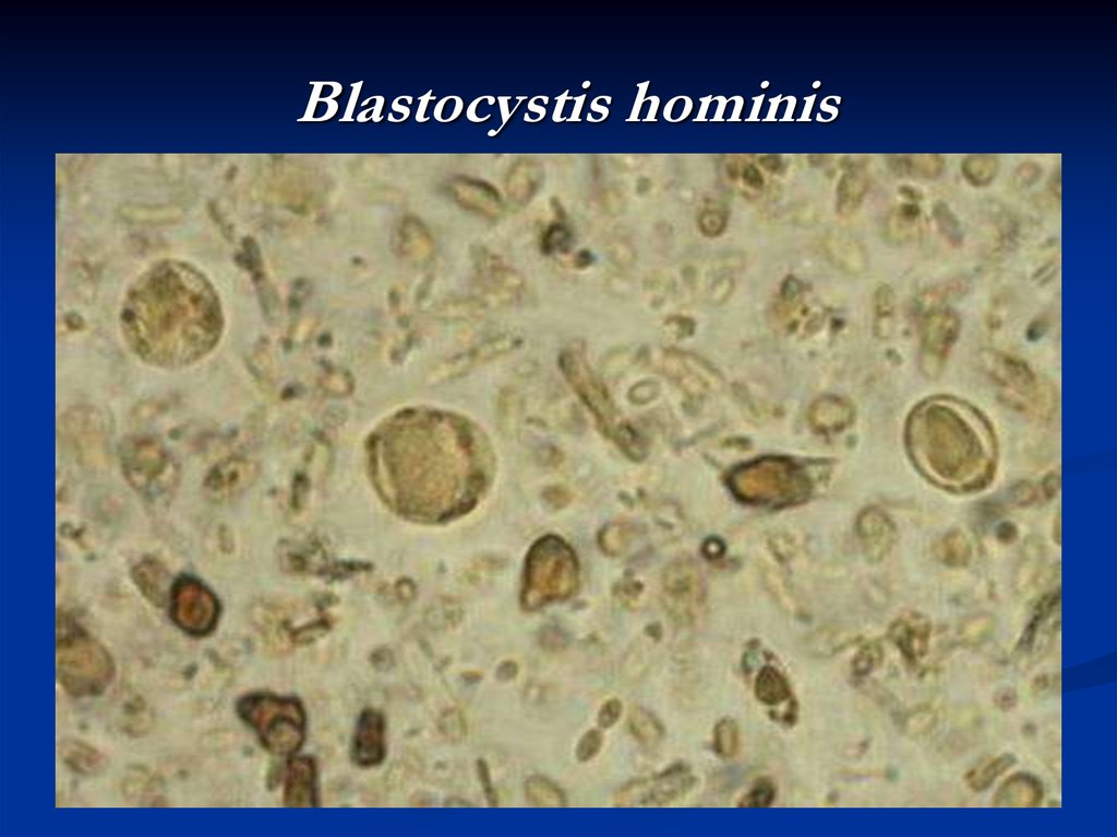 Простейшие в кале лечение. Blastocystis Hominis трофозоиты.