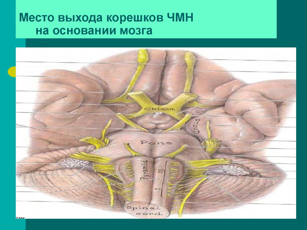 9 черепной нерв. Место выхода Корешков ЧМН. Корешки черепно-мозговых нервов. Черепно мозговые нервы топографическая анатомия. Черепные нервы корешки.