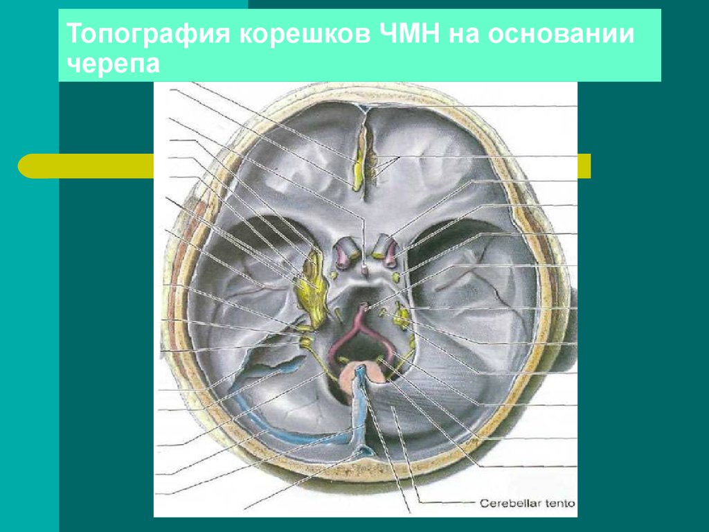 Промежуточный черепной нерв. Черепные нервы анатомия топография. Топография Корешков черепно-мозговых нервов. Топография черепно-мозговых нервов на основании черепа. ЧМН топографическая анатомия.