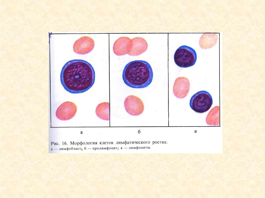 Ряд клеток. Лимфобласты пролимфоциты лимфоциты. К клетки лимфоцит морфология. Клетка лимфоцитов лимфобласт. Средний и малый лимфоцит.