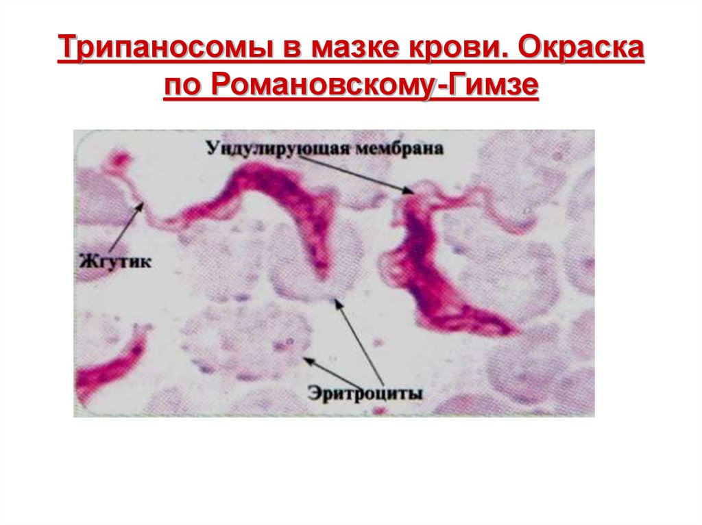 Окраска по Романовскому