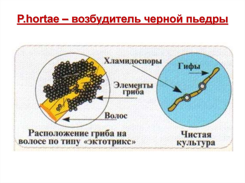 Черная пьедра фото