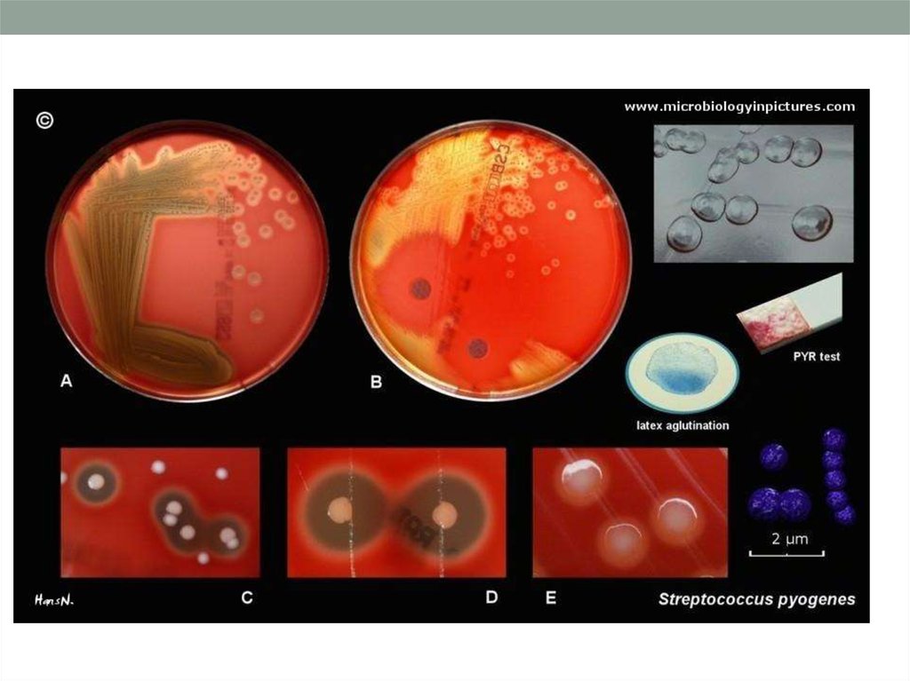 Тест стрептококк группы а. Пневмококк на кровяном агаре. Альфа гемолитический стрептококк. Гемолитический стрептококк колонии.