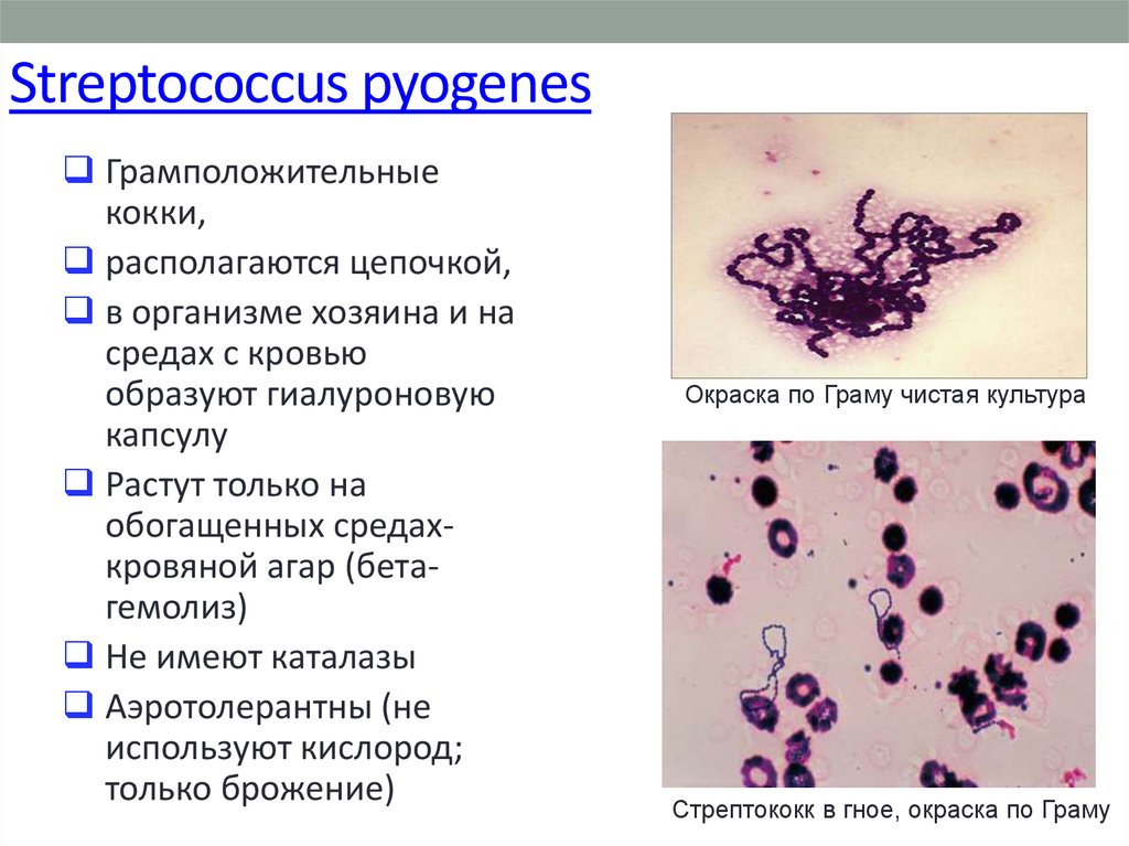 Streptococcus pyogenes.