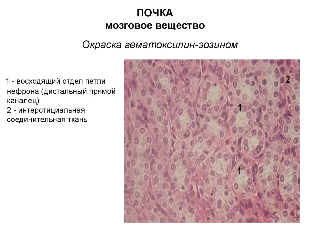 Ткани почки. Почка окраска гематоксилин-эозином. Препарат - почка. Окраска гематоксилин-эозином.. Соединительная ткань гематоксилин эозин. Почка препарат гематоксилин эозин.