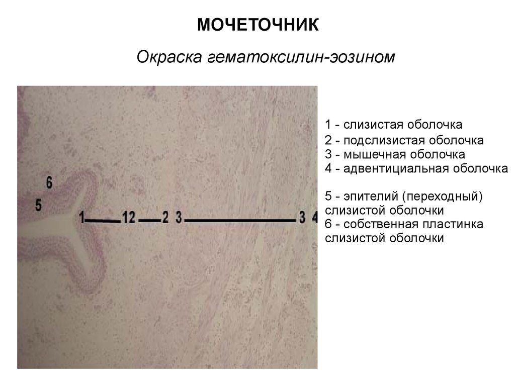 Мочеточник окраска гематоксилин-эозином. Мочеточник гематоксилин эозин. Подслизистая оболочка мочеточника.