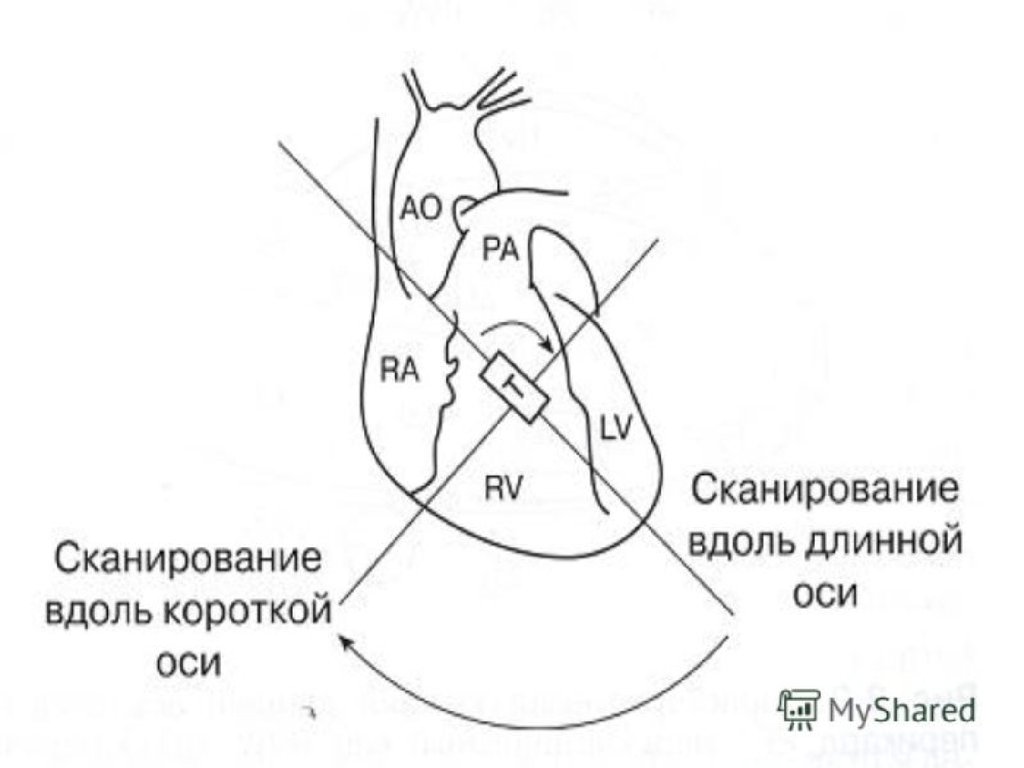 Длинная ось. Эхо кг сердца схема. Позиции эхокардиографии. Позиции датчика при эхокардиографии. Позиции ЭХОКГ схема.