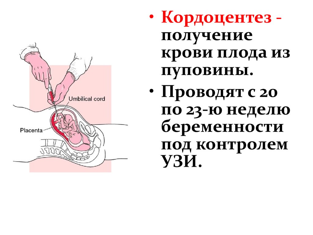 Placenta baja que hacer para que suba