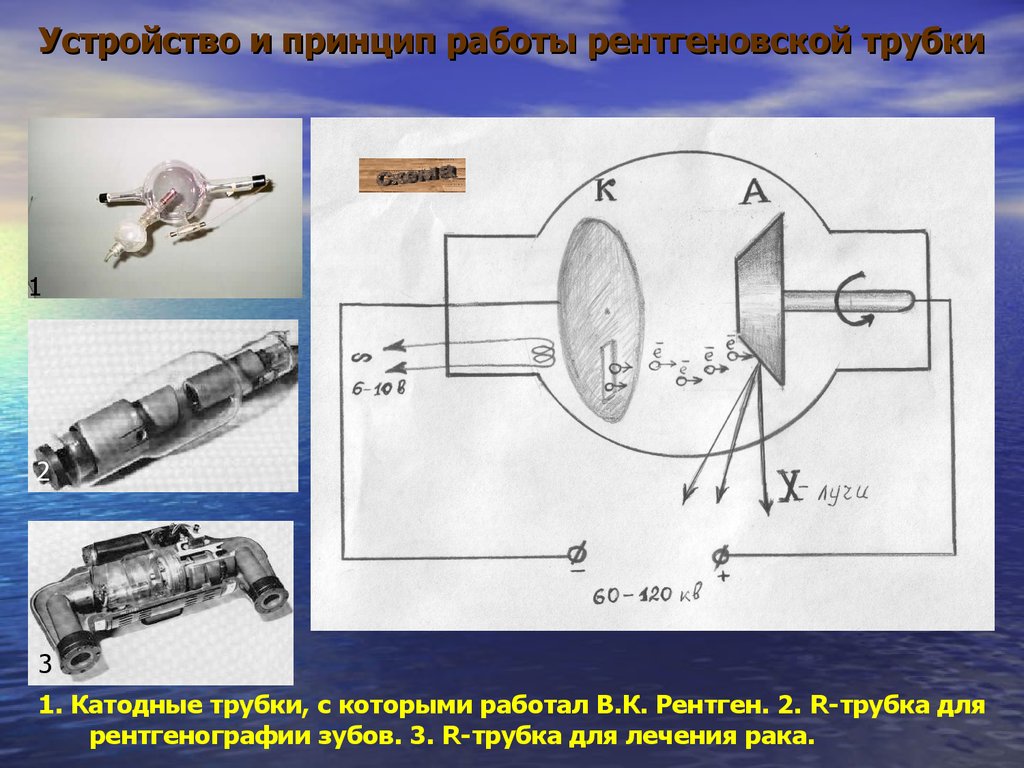 Принцип получения рентгеновского изображения