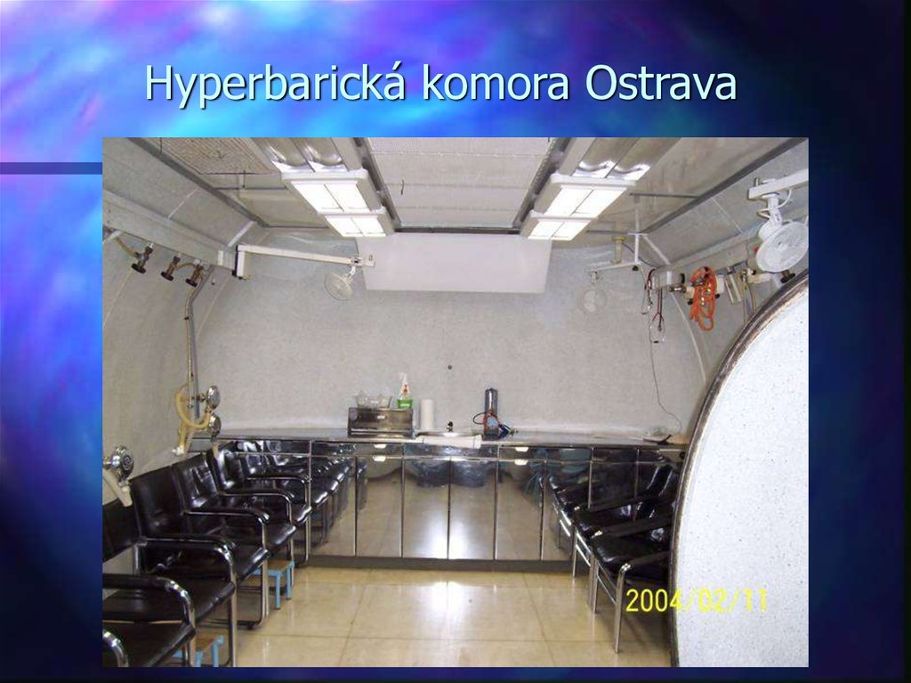 Hyperbarická komora Ostrava