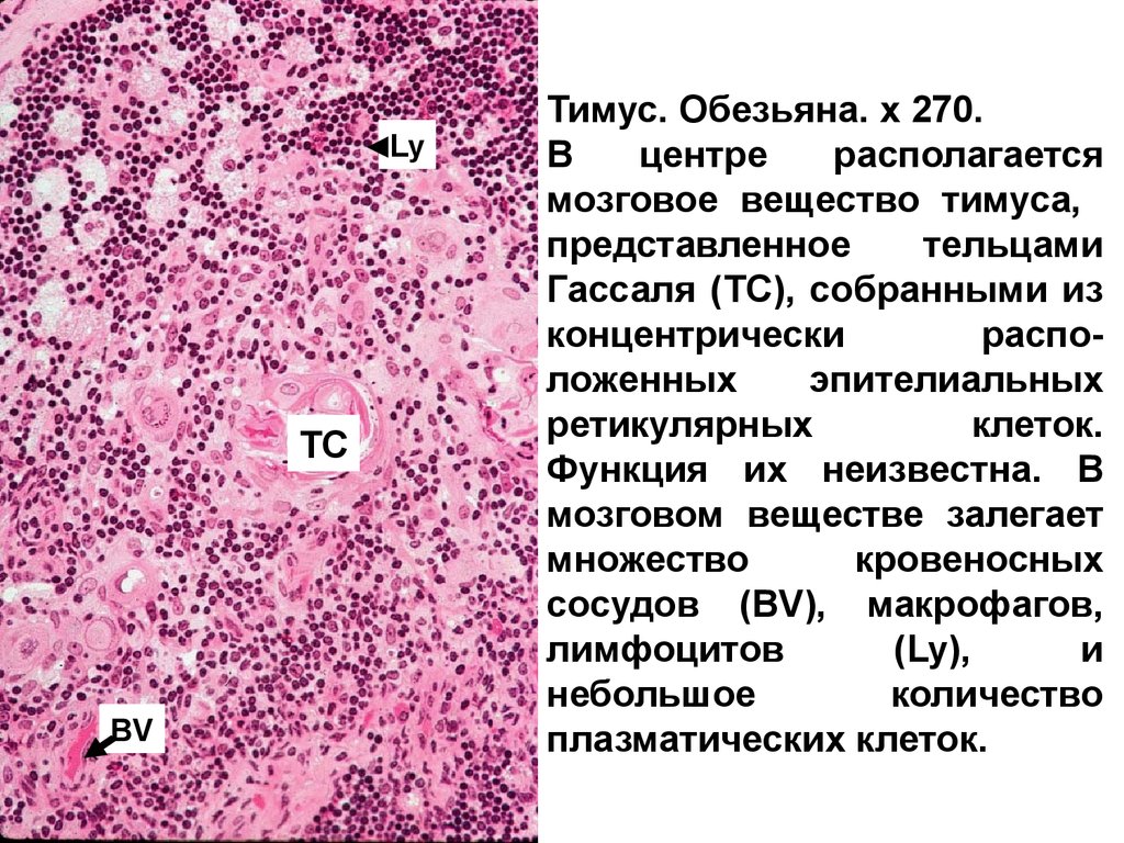 Мозговое вещество. Тимус тельце Гассаля гистология. Вилочковая железа тельца Гассаля. Тимус препарат гистология тельце Гассаля. Тельца тимуса гистология.