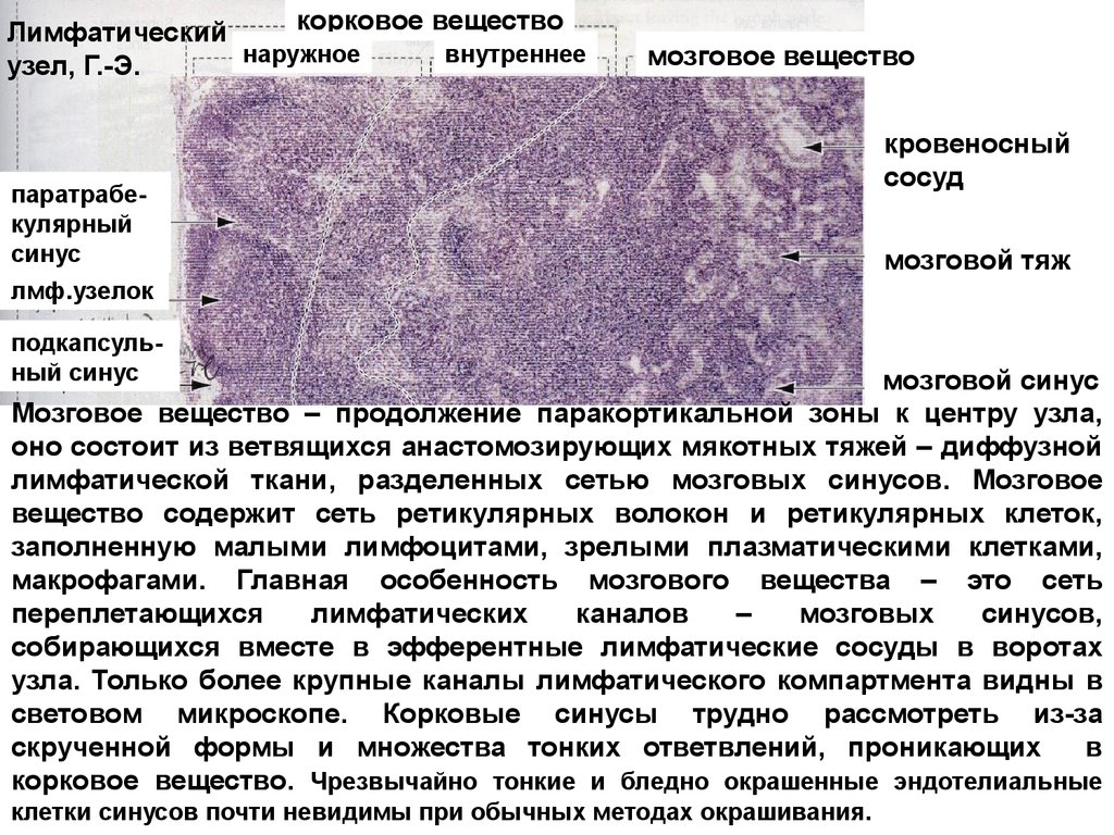 Представить препарат. Лимфатический узел описание гистология. Мозговое вещество лимфатического узла. Корковое и мозговое вещество лимфатического узла. Строение мозгового вещества лимфатического узла.