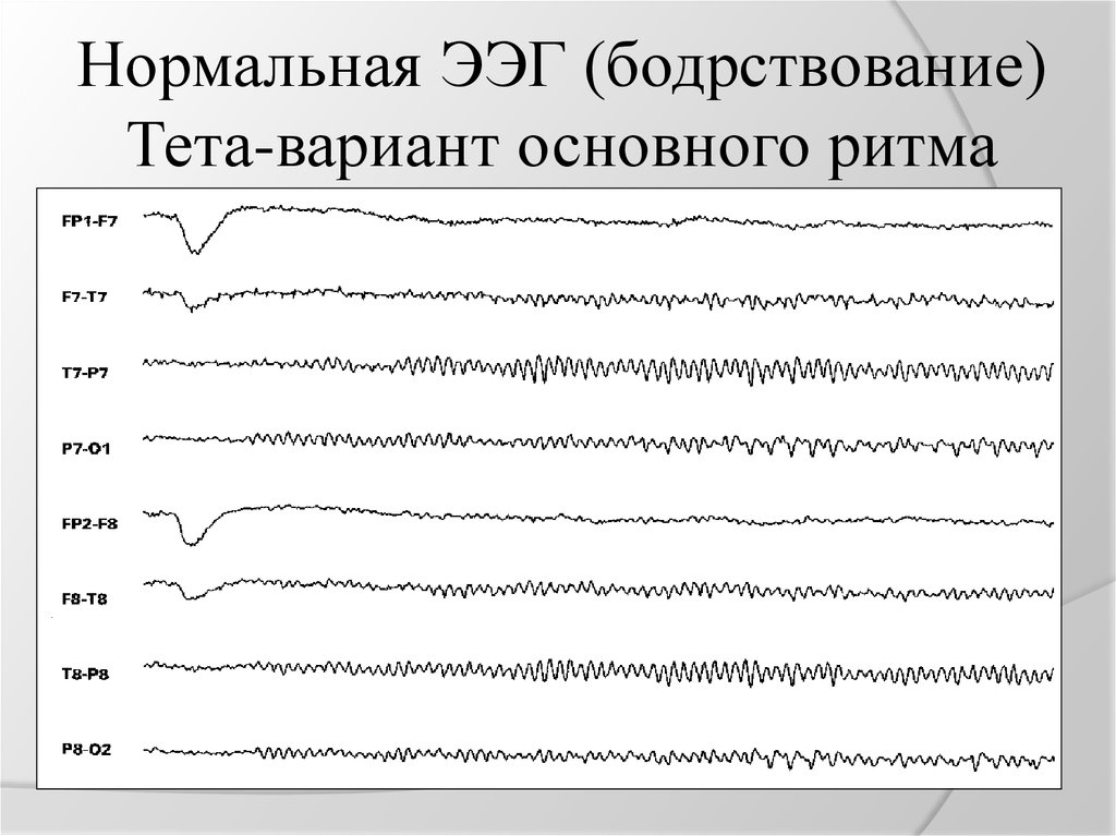 Нормальная ээг у взрослого фото