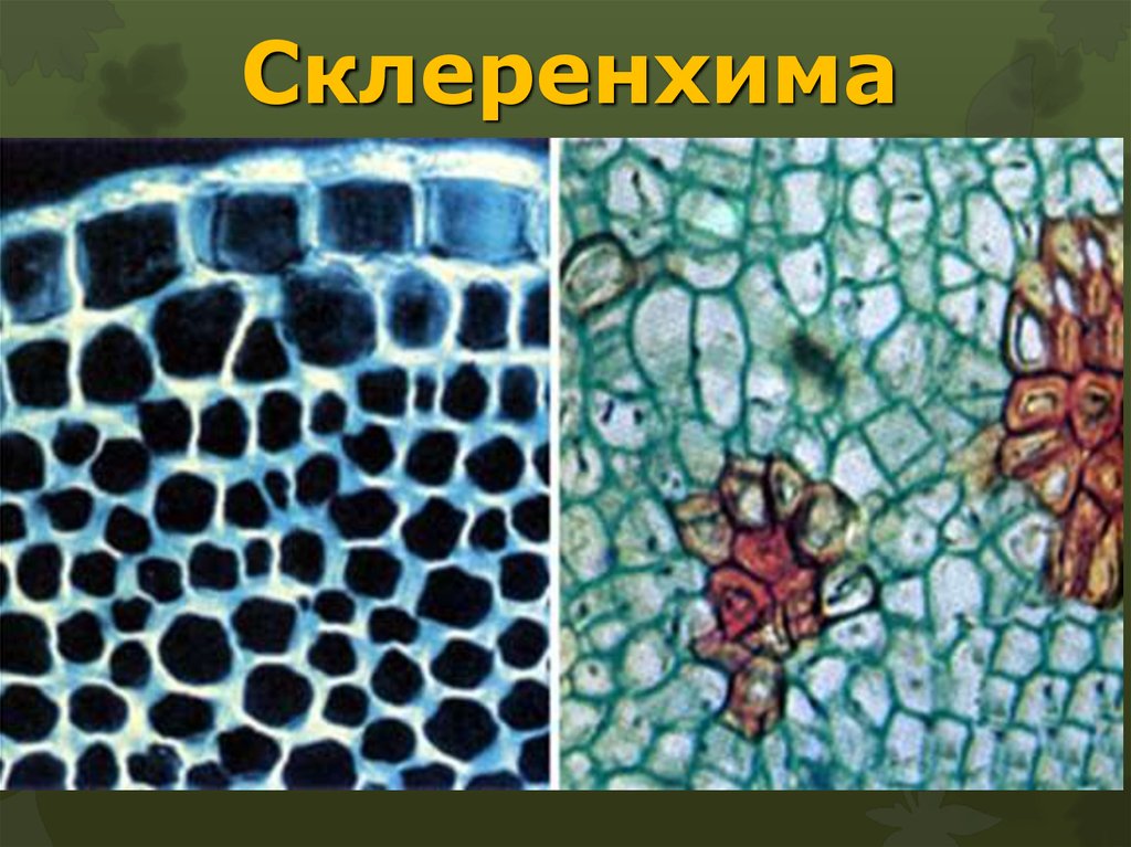 Рисунок группы клеток. Склеренхима ткани растений. Механическая ткань склеренхима. Механические ткани колленхима склеренхима склереиды. Склеренхима растений под микроскопом.