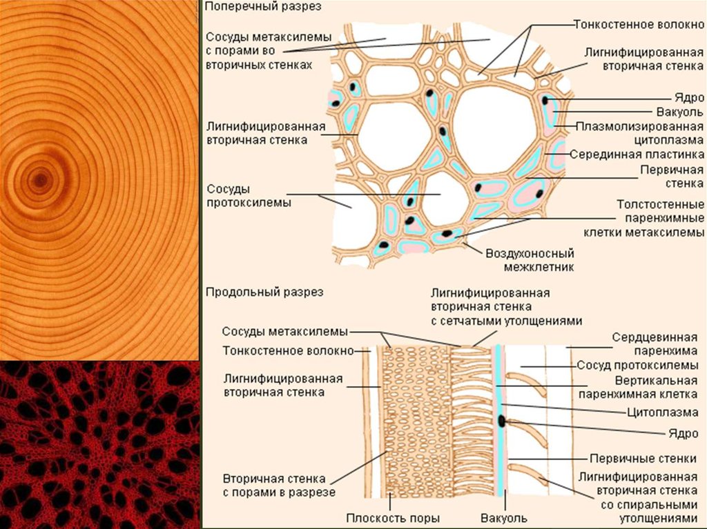 Стенки сосудов ткань. Ксилема древесная паренхима. Строение первичной ксилемы. Строение клеток ксилемы. Сосуды первичной ксилемы.