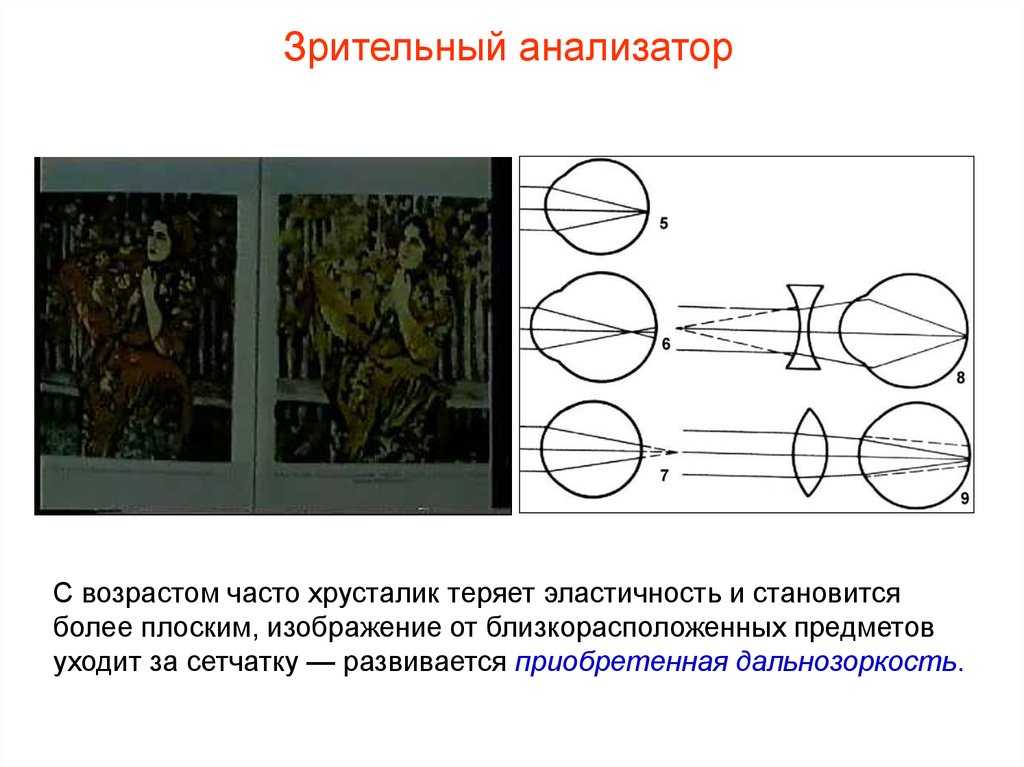 Зрение понятие. Возрастные особенности зрительного анализатора. Перечислите возрастные особенности зрительного анализатора.. Возрастные особенности органа зрения и зрительного анализатора. Анализаторы. Возрастные особенности зрительного анализаторов;.