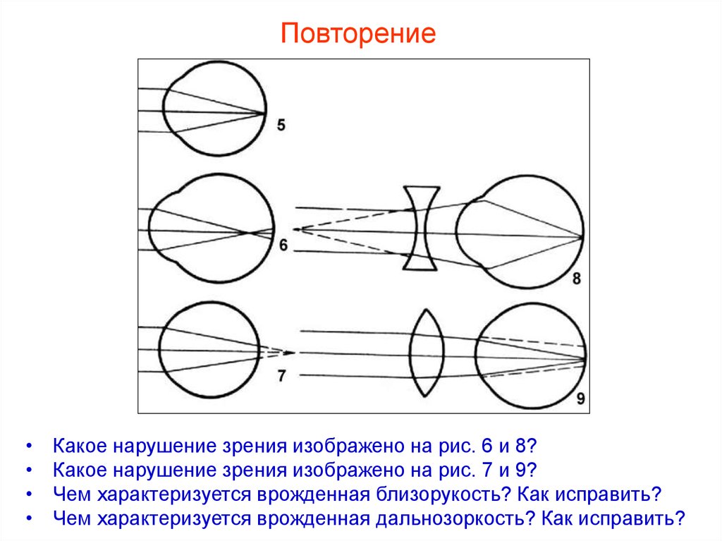 Какие дефекты зрения изображены на рисунках предложите дорисуйте способы их исправления