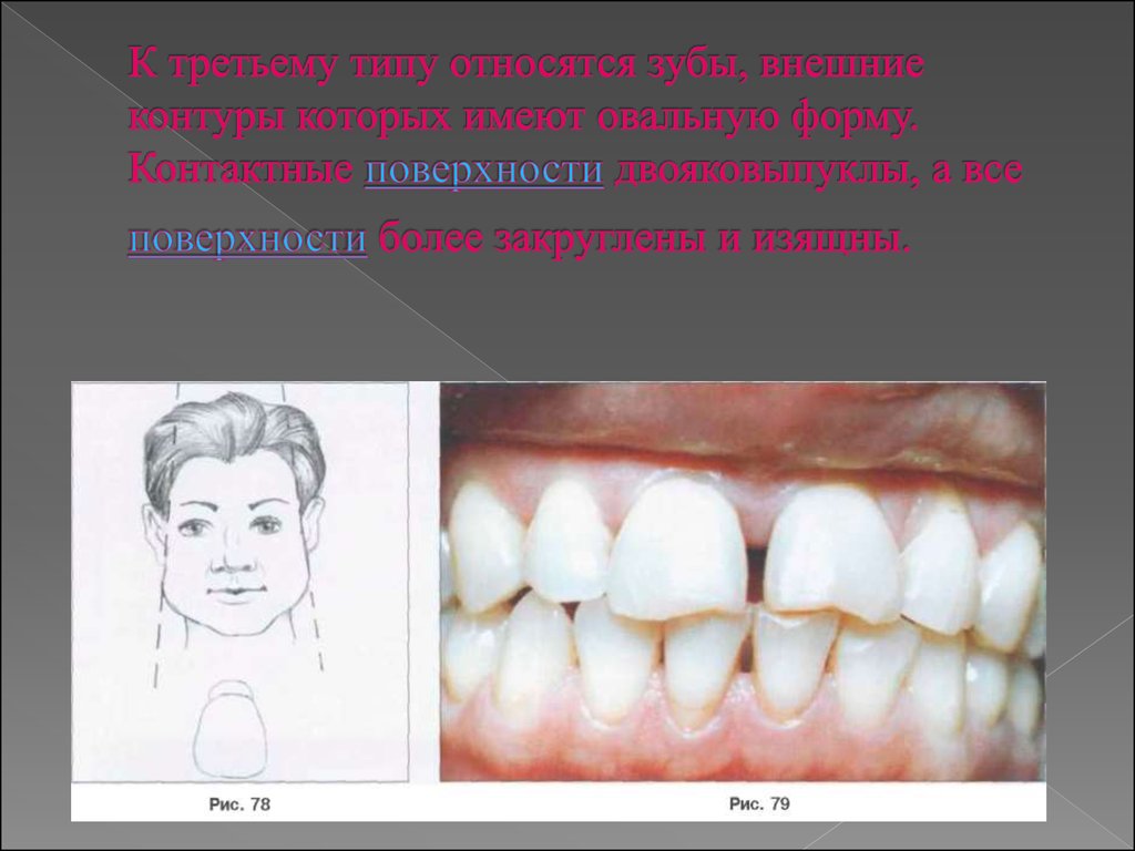 Искусственные зубы и их виды презентация