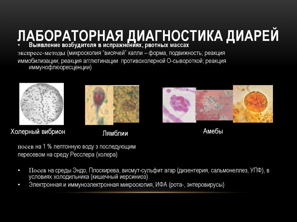 Диагностика диареи. Методы лабораторной диагностики диареи. Методы лабораторной диагностика диарей. Лабораторная диагностика при диарее. Диарея методы диагностики.