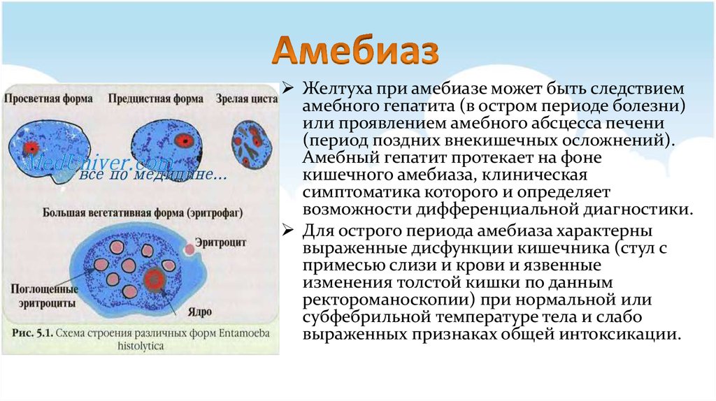 Заболевания вызванные амебами. Клинические проявления амебиаза. Проявления внекишечного амебиаза.