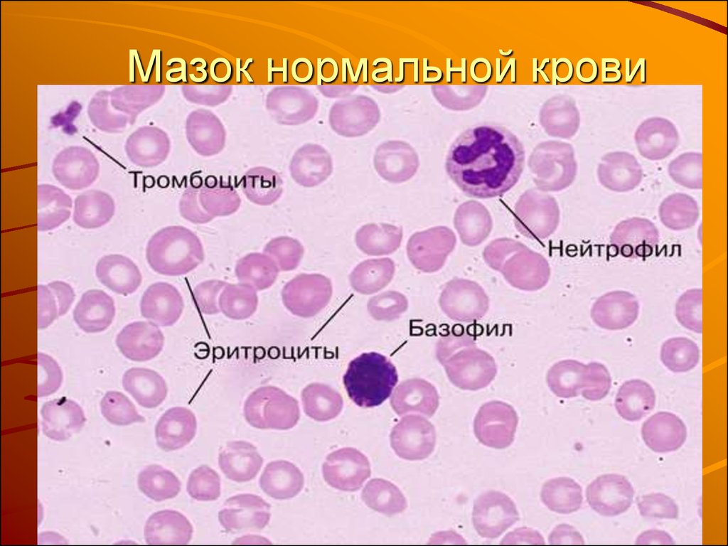 Тромбоциты в мазке крови фото