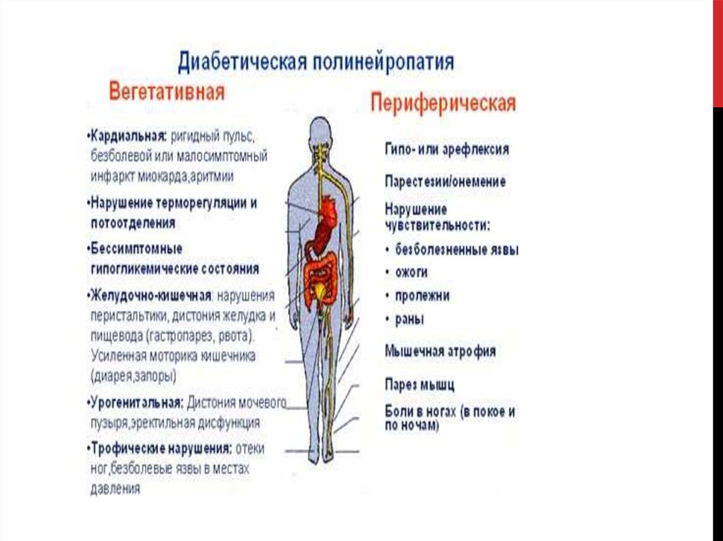 Нейропатия конечностей ног. Диабетическая периферическая полинейропатия симптомы. Этиология диабетической полинейропатии. Лекарства при полинейропатии нижних конечностей. Алкогольная полинейропатия патогенез.