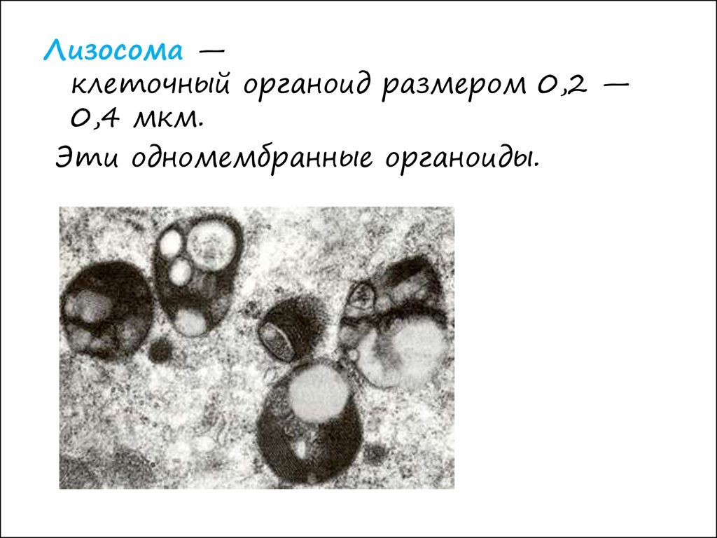 Рисунок лизосомы клетки. Патология лизосом. Ультраструктура лизосом. Патология лизосом болезни накопления. Патология лизосом патфиз.