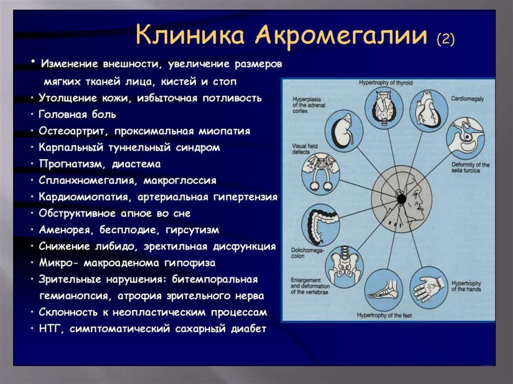 Акромегалия и гигантизм презентация