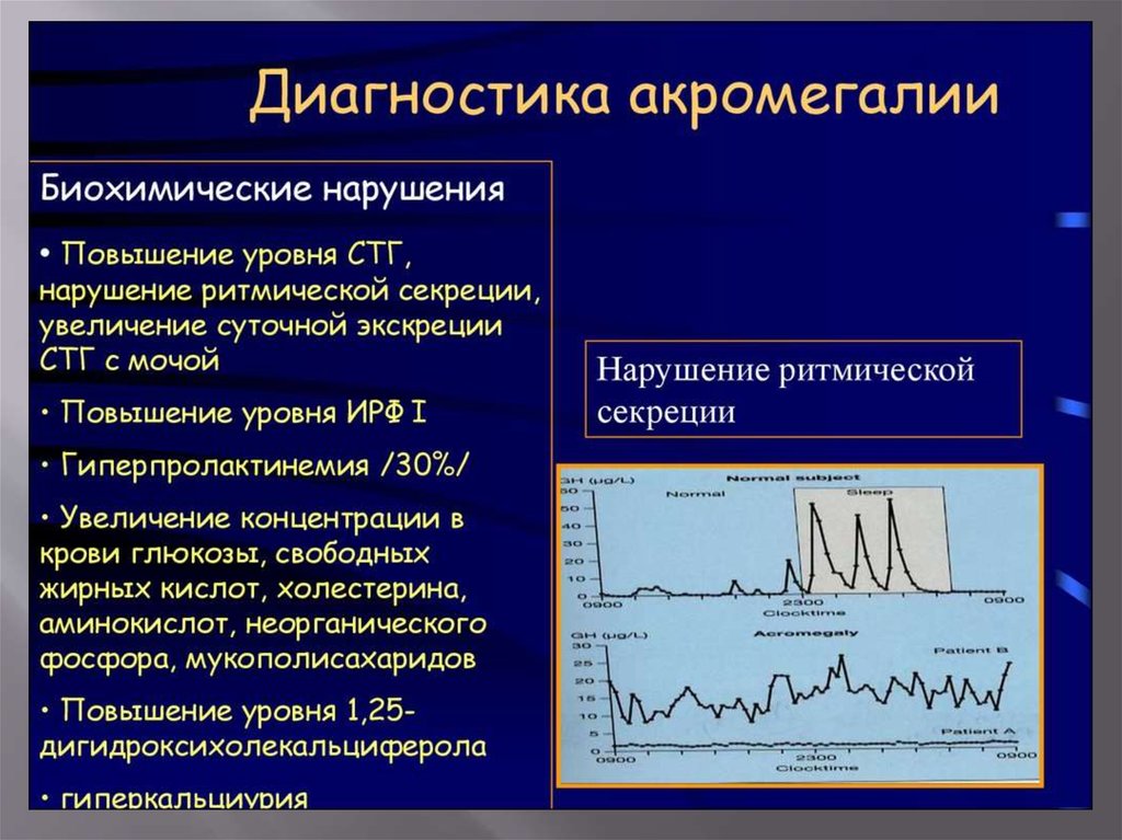 Акромегалия и гигантизм презентация