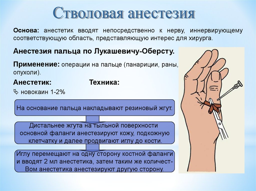Местная анестезия форум. Анестезия пальца по Лукашевичу. Проводниковая анестезия пальца. Местная анестезия по Оберсту-Лукашевичу.