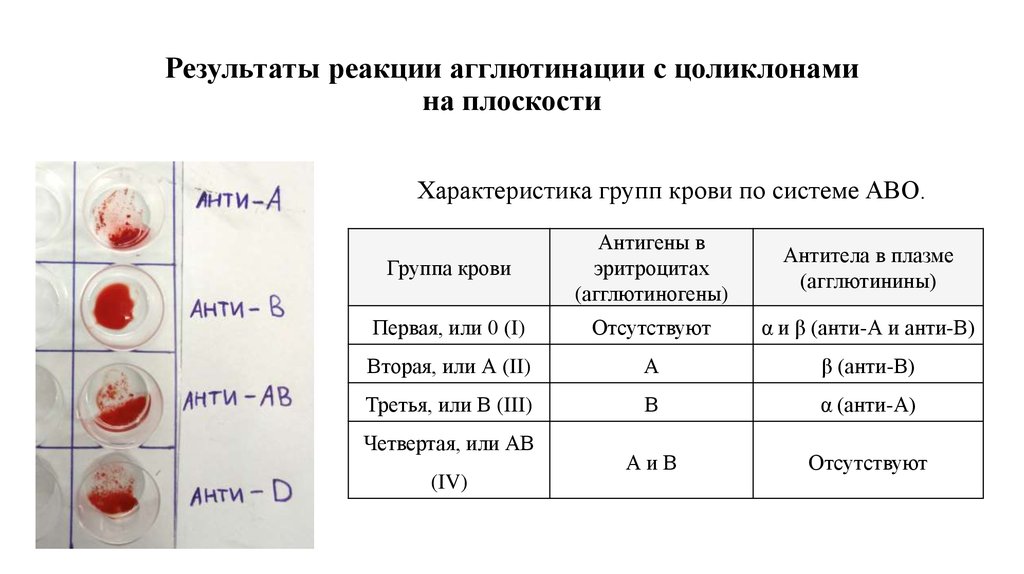 Группа c результаты. Резус фактор цоликлонами таблица. Цоликлоны для определения группы крови таблица. Определение группы крови агглютинация таблица. Реакция агглютинации для определения резус фактора.