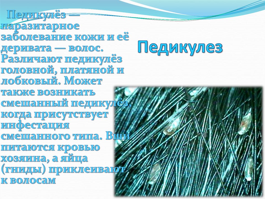 Педикулез чесотка. Характеристика педикулеза. Педикулёз что это такое информация для родителей. Профилактика педикулеза.