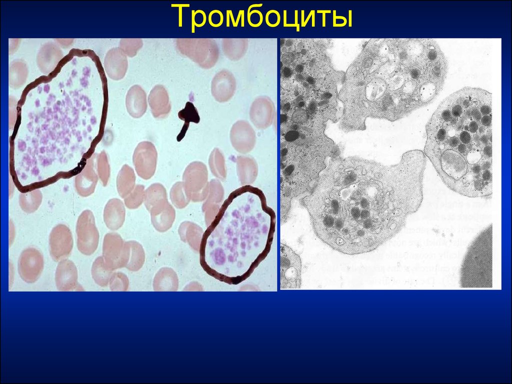 Тромбоциты. Тромбоциты кровяные пластинки. Тромбоциты это. Как выглядят тромбоциты.