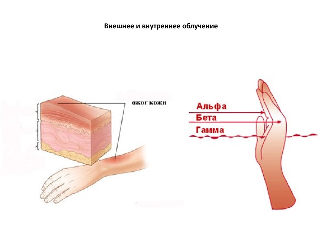 Внешнее и внутреннее облучение человека