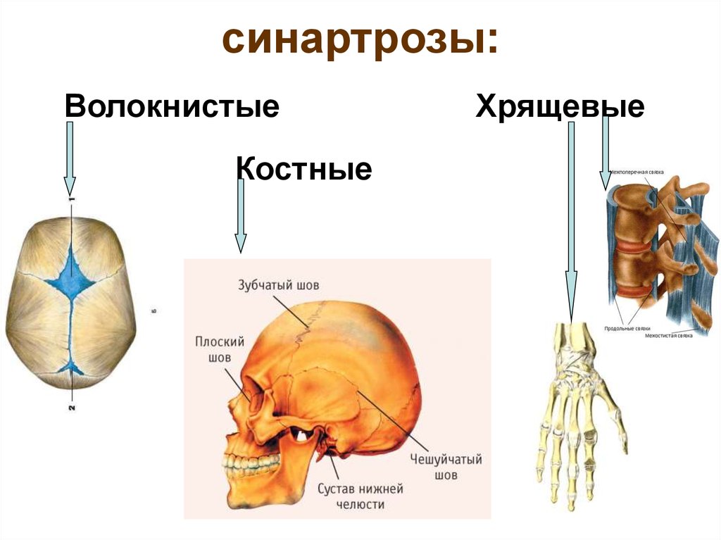Непрерывные кости. Типы соединения костей синартрозы. Непрерывные соединения костей синартрозы. Синартроз синдесмоз синхондроз. Соединения костей непрерывные соединения синдесмозы.