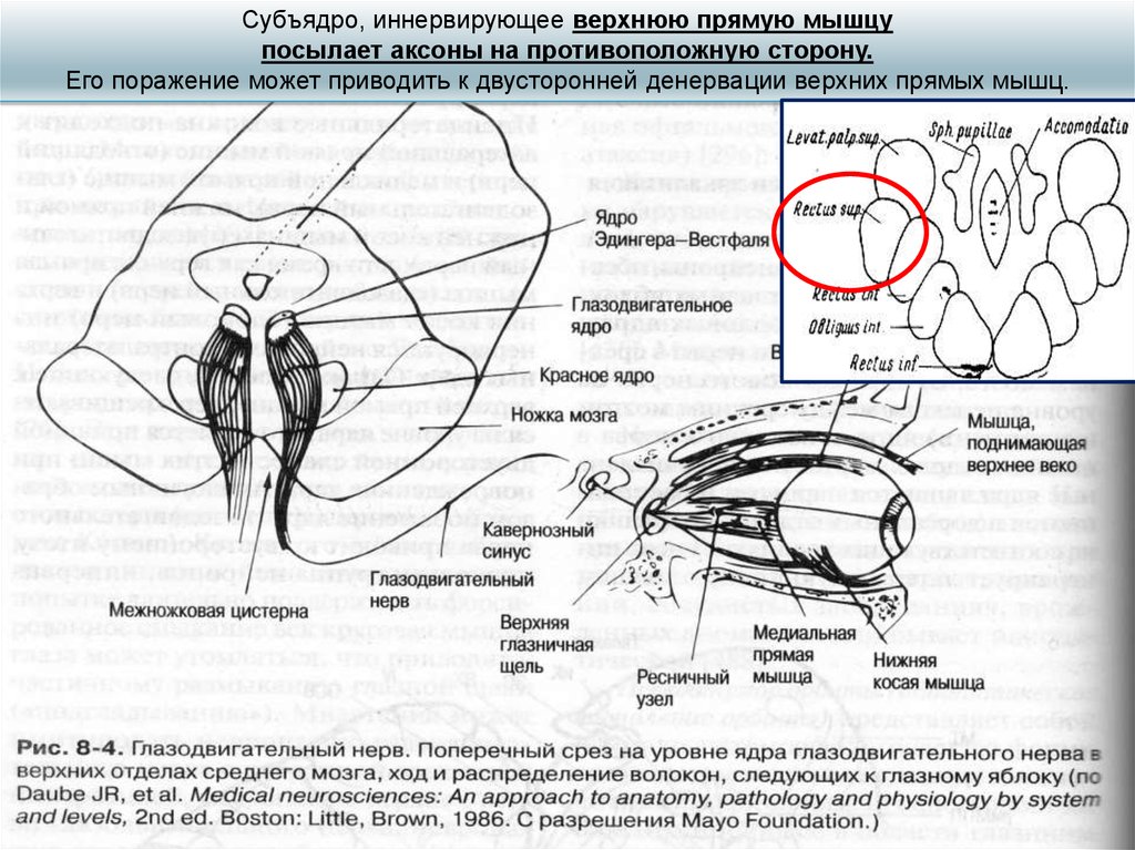 Глазодвигательный нерв мышцы. Глазодвигательный нерв неврология схема. Путь глазодвигательного нерва схема. Глазодвигательный нерв ход волокон. Ядра глазодвигательного нерва схема.