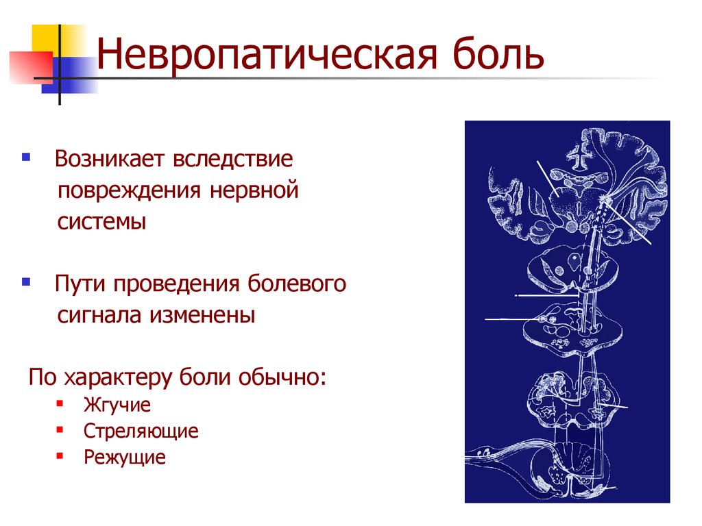 Невропатическая боль. Виды болевой чувствительности. Невропатического характера боли. Невропатическая боль характеристика.