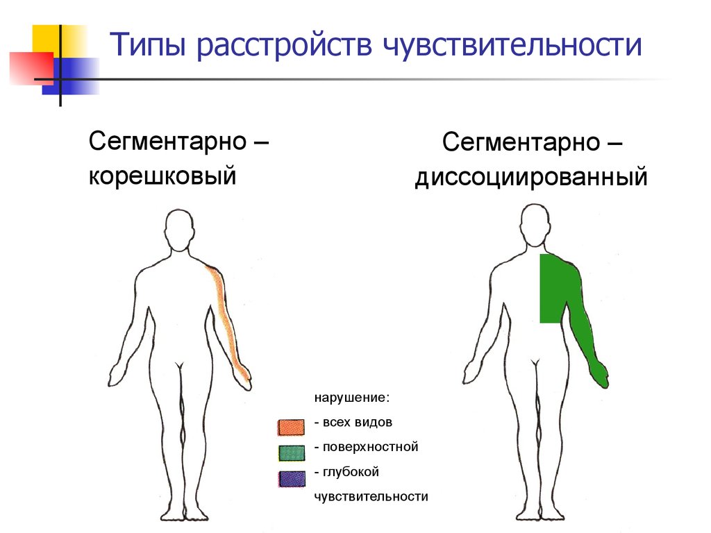 Нарушение чувствительности неврология презентация