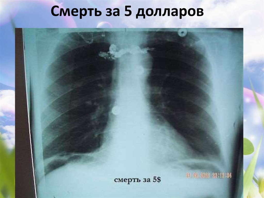 Смерть за 5 долларов